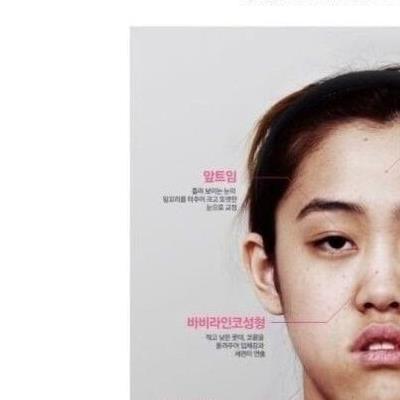 '렛미인 주걱턱녀' 8년 후 현재 근황