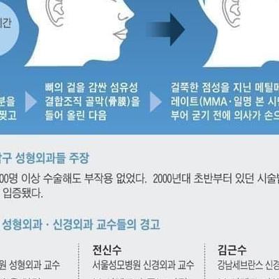 무시무시한요즘성형수술.jpg